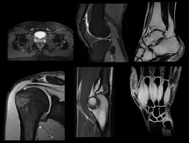 聯(lián)影醫(yī)療發(fā)布業(yè)界首臺中醫(yī)磁共振成像系統(tǒng)