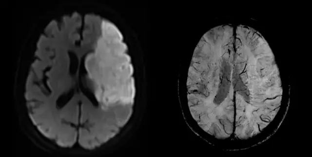 聯(lián)影醫(yī)療發(fā)布業(yè)界首臺中醫(yī)磁共振成像系統(tǒng)