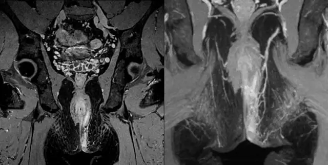 聯(lián)影醫(yī)療發(fā)布業(yè)界首臺中醫(yī)磁共振成像系統(tǒng)